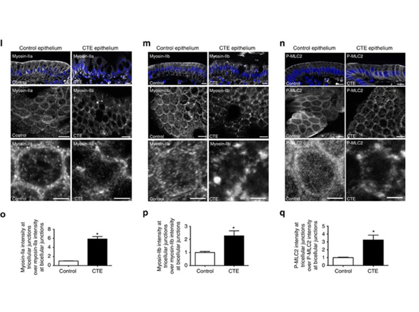 Immunofluorescence using pMLC